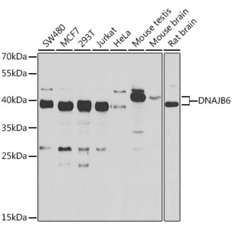 Western Blot - Anti-DNAJB6 Antibody (A15510) - Antibodies.com