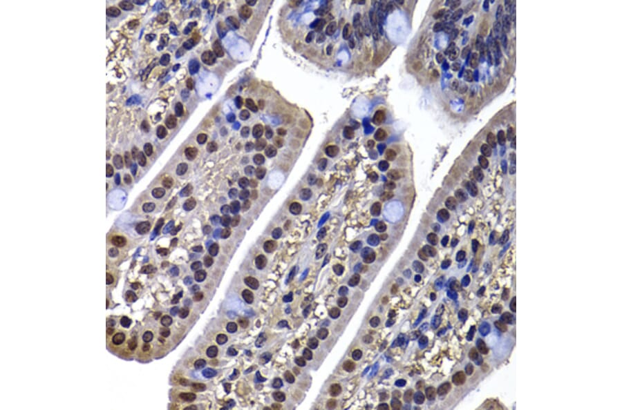 Immunohistochemistry - Anti-DNAJB6 Antibody (A15510) - Antibodies.com