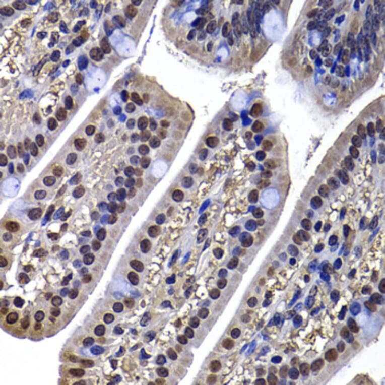 Immunohistochemistry - Anti-DNAJB6 Antibody (A15510) - Antibodies.com