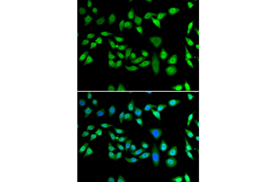 Immunofluorescence - Anti-DNAJB6 Antibody (A15510) - Antibodies.com