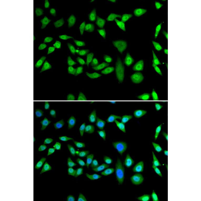 Immunofluorescence - Anti-DNAJB6 Antibody (A15510) - Antibodies.com