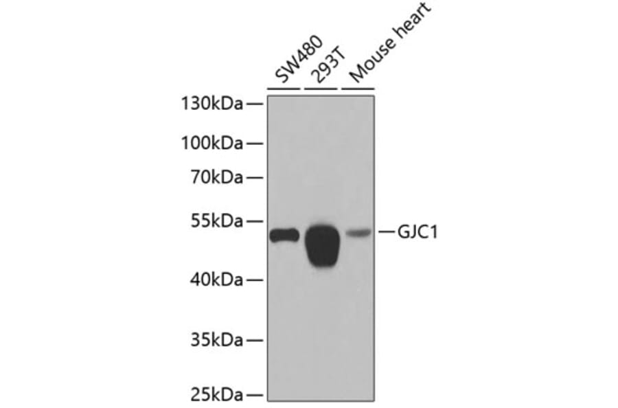 Western Blot - Anti-Connexin 45 / GJA7 / Cx45 Antibody (A15511) - Antibodies.com