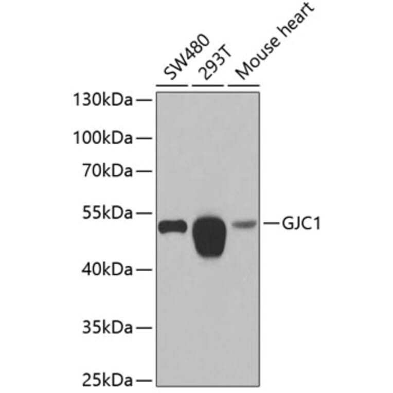 Western Blot - Anti-Connexin 45 / GJA7 / Cx45 Antibody (A15511) - Antibodies.com