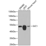 Western Blot - Anti-Connexin 45 / GJA7 / Cx45 Antibody (A15511) - Antibodies.com