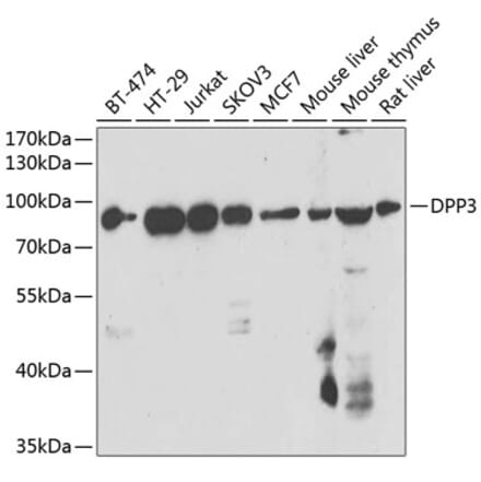 Western Blot - Anti-DPP3 Antibody (A15512) - Antibodies.com