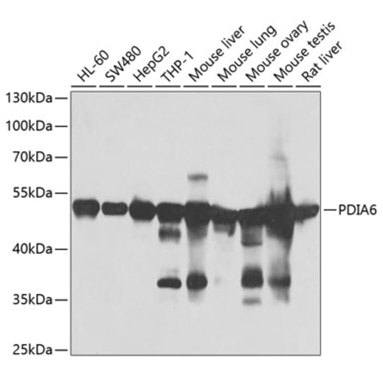 Western Blot - Anti-PDIA6 Antibody (A15513) - Antibodies.com
