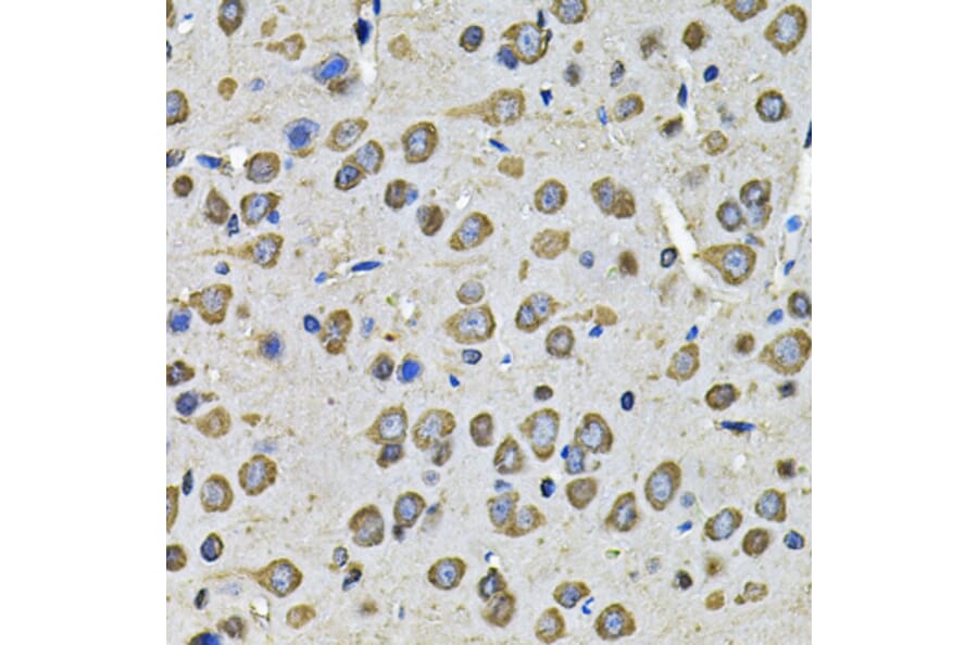 Immunohistochemistry - Anti-PDIA6 Antibody (A15513) - Antibodies.com