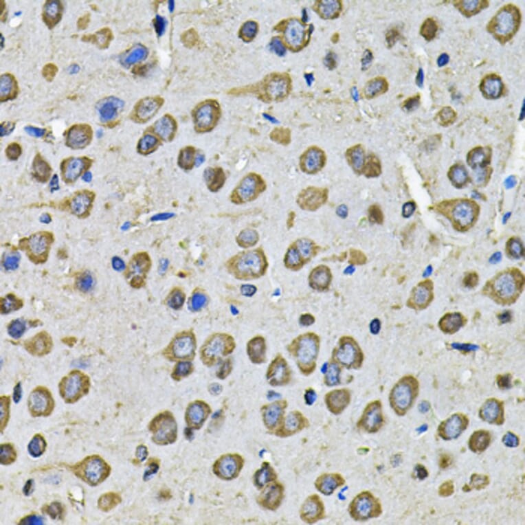 Immunohistochemistry - Anti-PDIA6 Antibody (A15513) - Antibodies.com