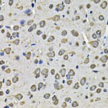 Immunohistochemistry - Anti-PDIA6 Antibody (A15513) - Antibodies.com