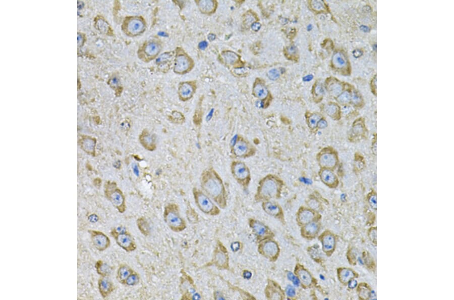 Immunohistochemistry - Anti-PDIA6 Antibody (A15513) - Antibodies.com