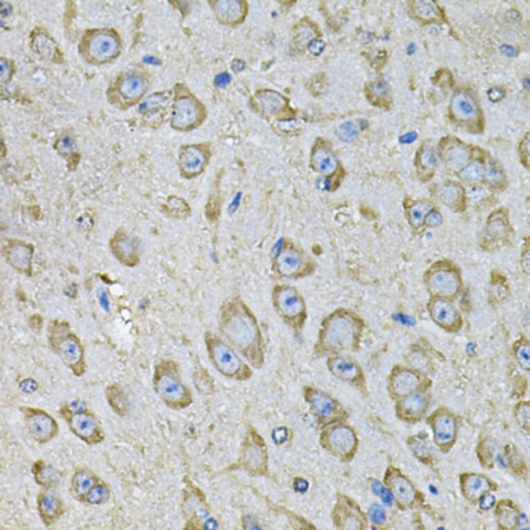 Immunohistochemistry - Anti-PDIA6 Antibody (A15513) - Antibodies.com