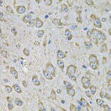 Immunohistochemistry - Anti-PDIA6 Antibody (A15513) - Antibodies.com