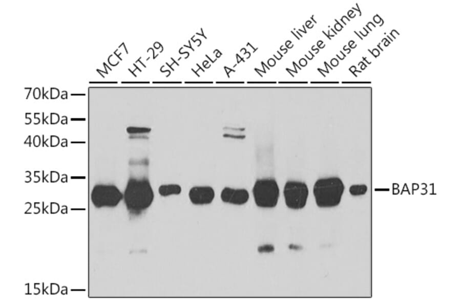 Western Blot - Anti-BAP31 Antibody (A15514) - Antibodies.com