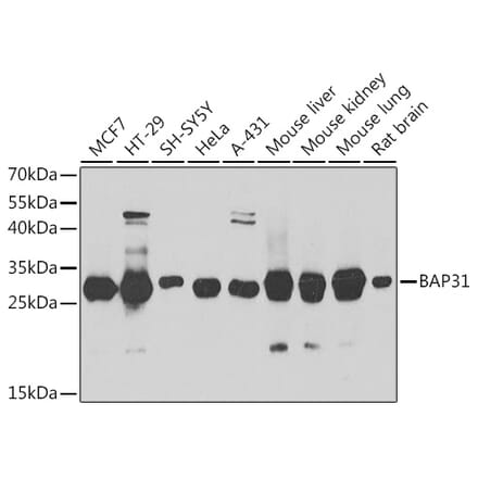 Western Blot - Anti-BAP31 Antibody (A15514) - Antibodies.com