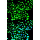 Immunofluorescence - Anti-BAP31 Antibody (A15514) - Antibodies.com