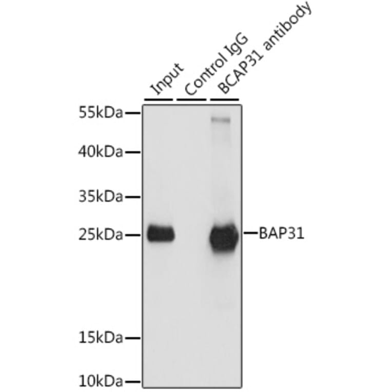 Western Blot - Anti-BAP31 Antibody (A15514) - Antibodies.com