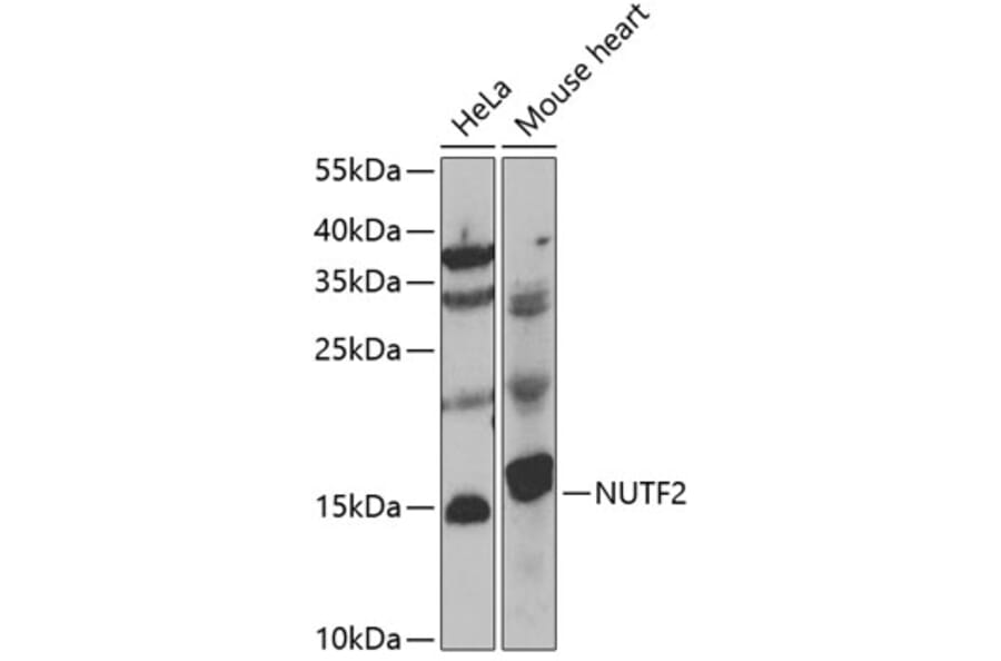 Western Blot - Anti-NUTF2 Antibody (A7057) - Antibodies.com