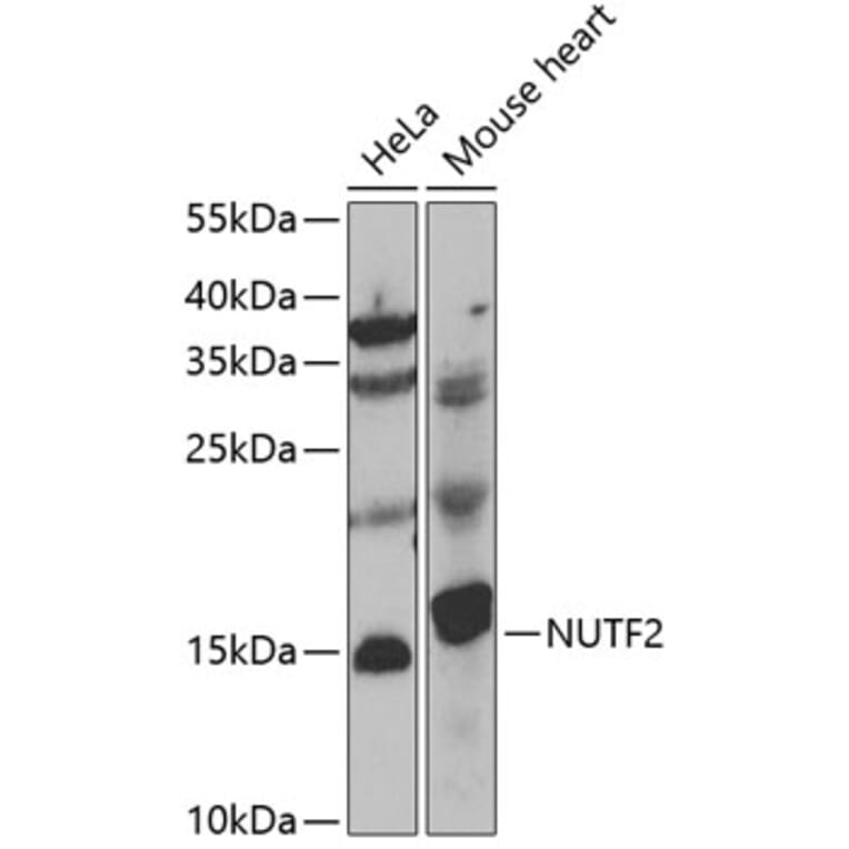 Western Blot - Anti-NUTF2 Antibody (A7057) - Antibodies.com