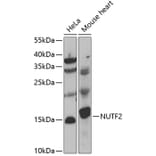 Western Blot - Anti-NUTF2 Antibody (A7057) - Antibodies.com