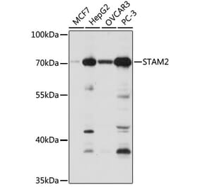 Western Blot - Anti-STAM2 Antibody (A15516) - Antibodies.com