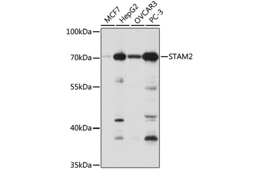Western Blot - Anti-STAM2 Antibody (A15516) - Antibodies.com