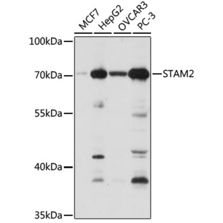 Western Blot - Anti-STAM2 Antibody (A15516) - Antibodies.com