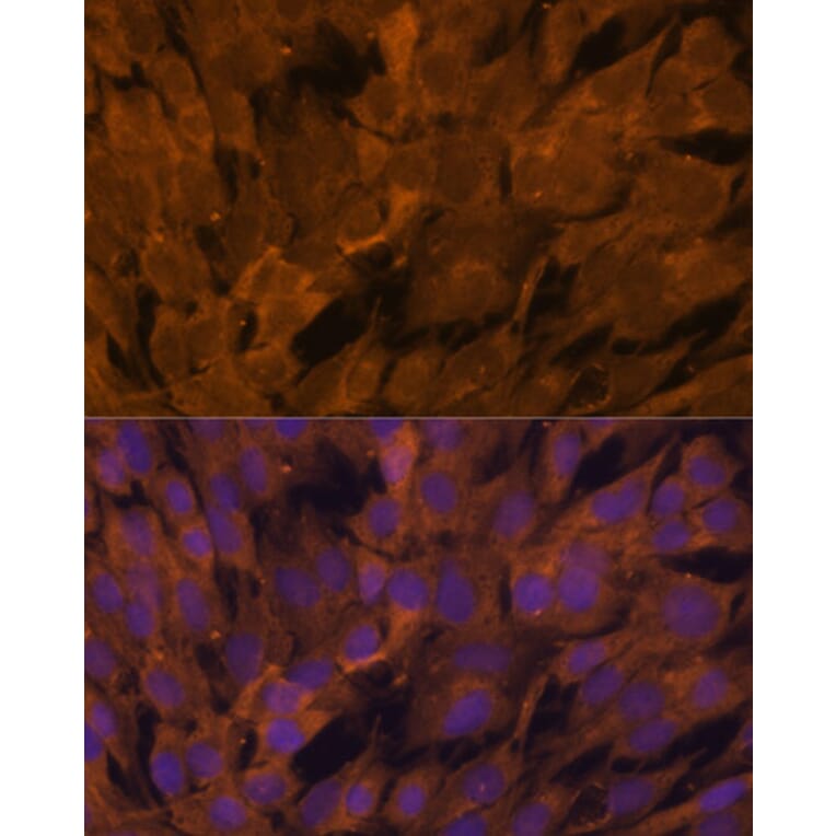 Immunofluorescence - Anti-STAM2 Antibody (A15516) - Antibodies.com