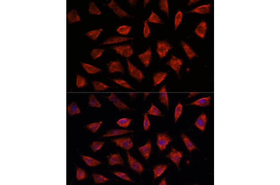 Immunofluorescence - Anti-STAM2 Antibody (A15516) - Antibodies.com