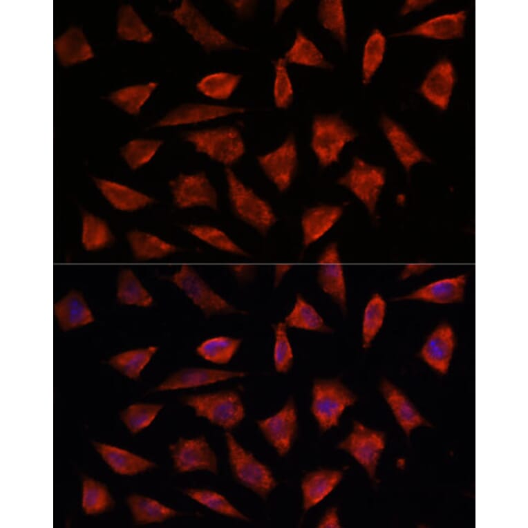 Immunofluorescence - Anti-STAM2 Antibody (A15516) - Antibodies.com