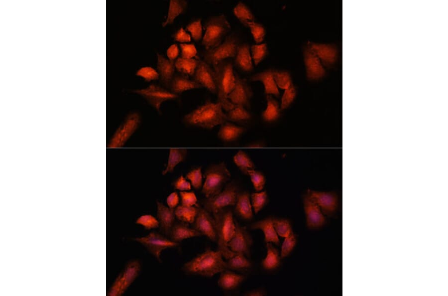 Immunofluorescence - Anti-STAM2 Antibody (A15516) - Antibodies.com