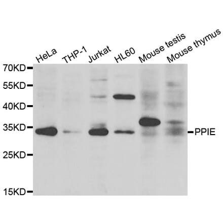 Western Blot - Anti-PPIE Antibody (A7061) - Antibodies.com