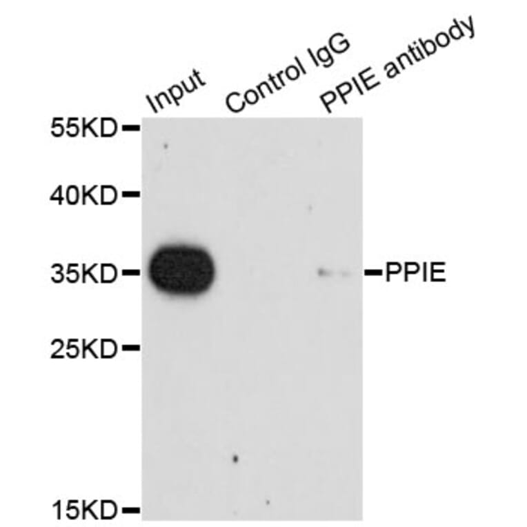 Immunoprecipitation - Anti-PPIE Antibody (A7061) - Antibodies.com