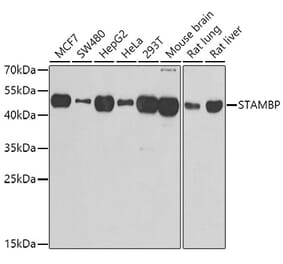 Western Blot - Anti-AMSH Antibody (A15519) - Antibodies.com