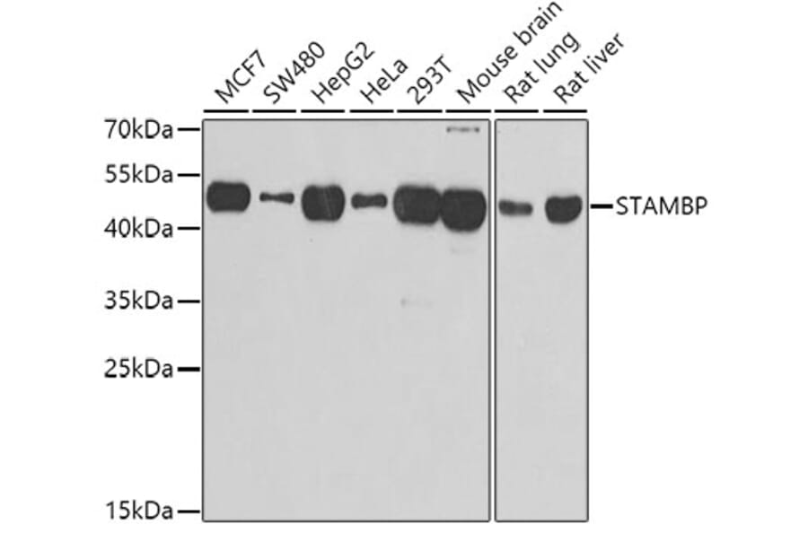 Western Blot - Anti-AMSH Antibody (A15519) - Antibodies.com