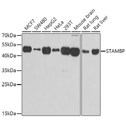 Western Blot - Anti-AMSH Antibody (A15519) - Antibodies.com