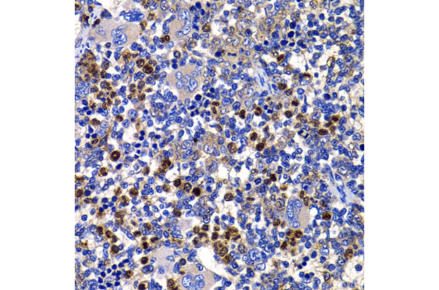 Immunohistochemistry - Anti-AMSH Antibody (A15519) - Antibodies.com