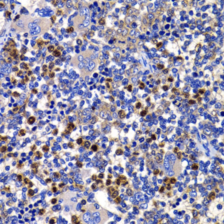 Immunohistochemistry - Anti-AMSH Antibody (A15519) - Antibodies.com