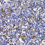 Immunohistochemistry - Anti-AMSH Antibody (A15519) - Antibodies.com