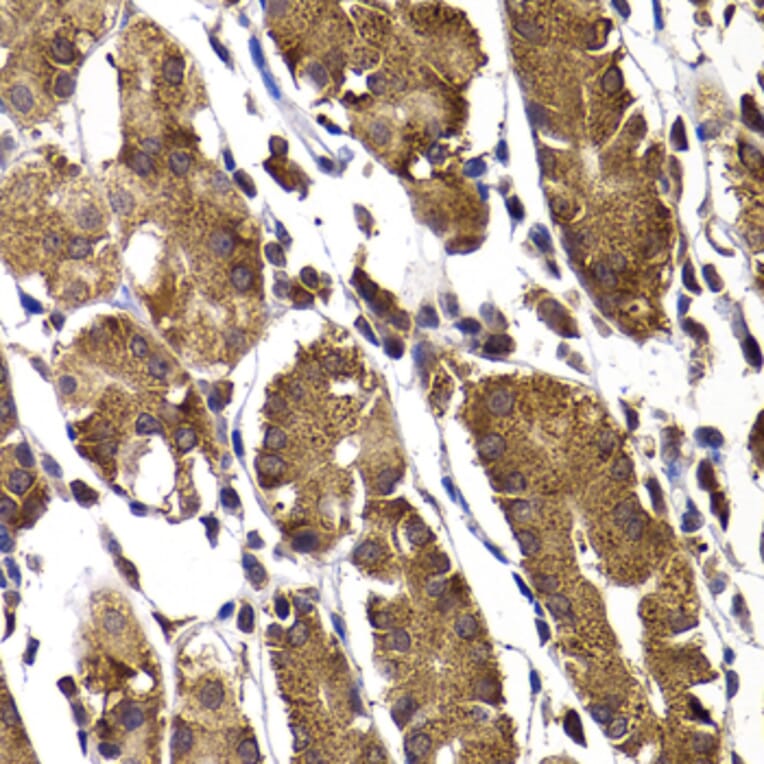 Immunohistochemistry - Anti-AMSH Antibody (A15519) - Antibodies.com