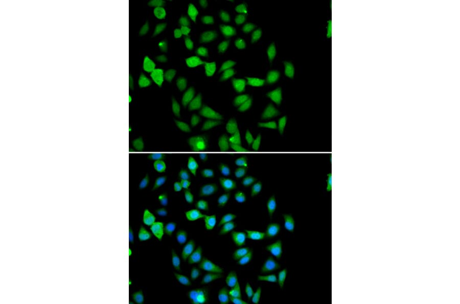 Immunofluorescence - Anti-AMSH Antibody (A15519) - Antibodies.com