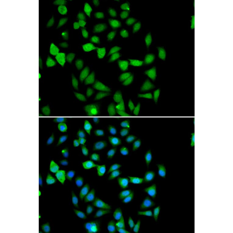 Immunofluorescence - Anti-AMSH Antibody (A15519) - Antibodies.com