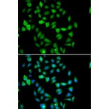 Immunofluorescence - Anti-AMSH Antibody (A15519) - Antibodies.com