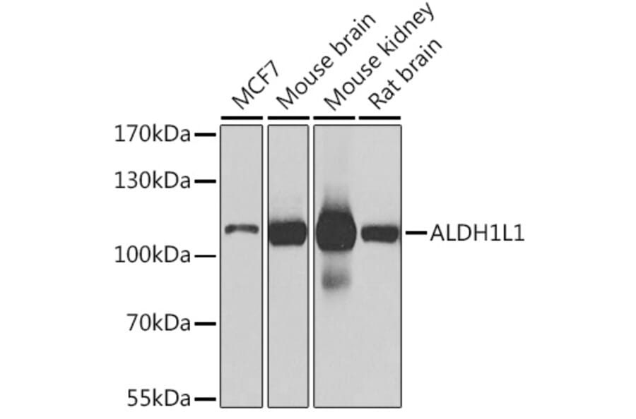 Western Blot - Anti-ALDH1L1 Antibody (A15520) - Antibodies.com