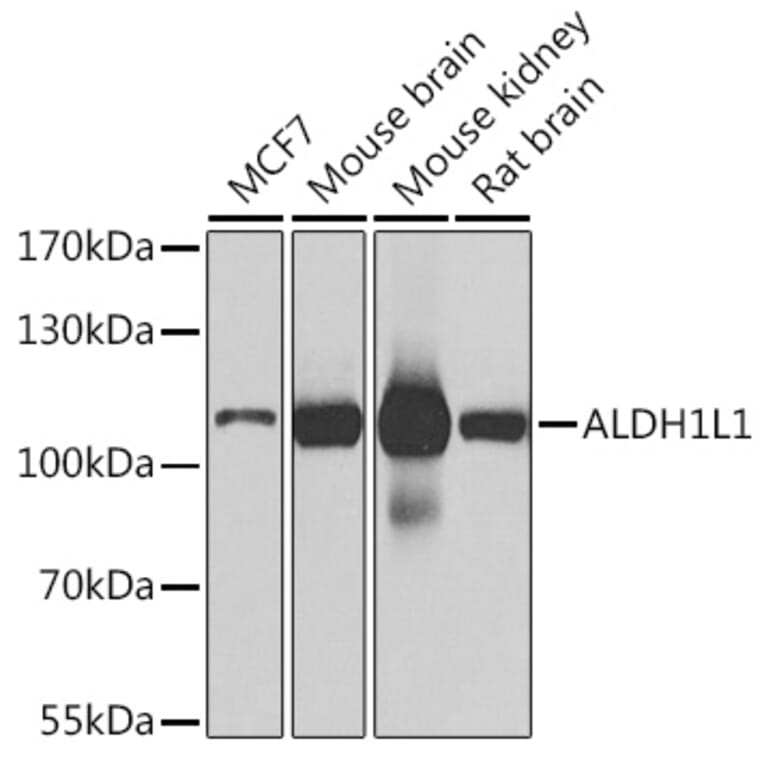 Western Blot - Anti-ALDH1L1 Antibody (A15520) - Antibodies.com