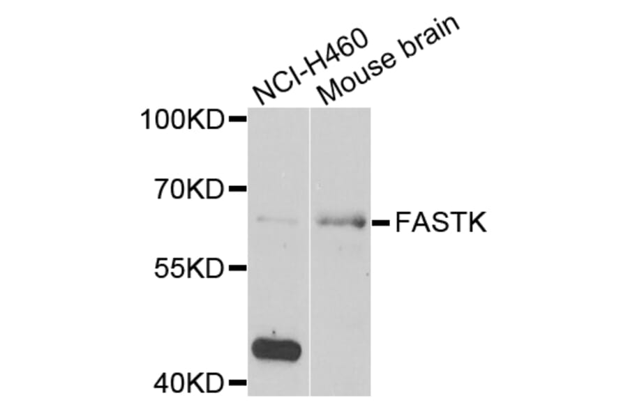 Western Blot - Anti-FASTK Antibody (A7069) - Antibodies.com
