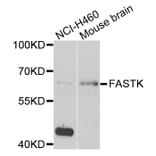 Western Blot - Anti-FASTK Antibody (A7069) - Antibodies.com