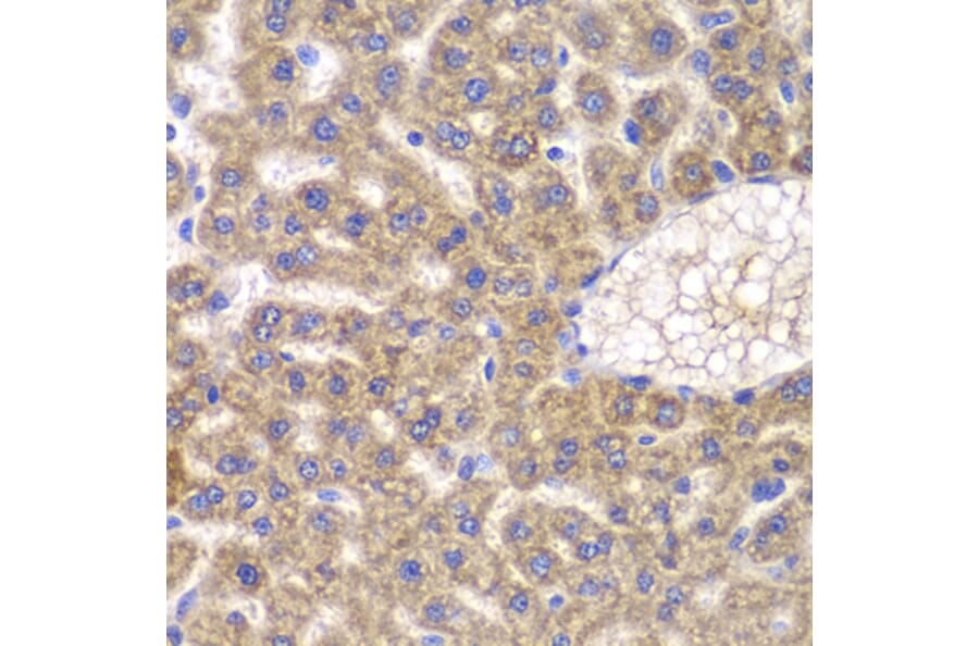 Immunohistochemistry - Anti-FASTK Antibody (A7069) - Antibodies.com