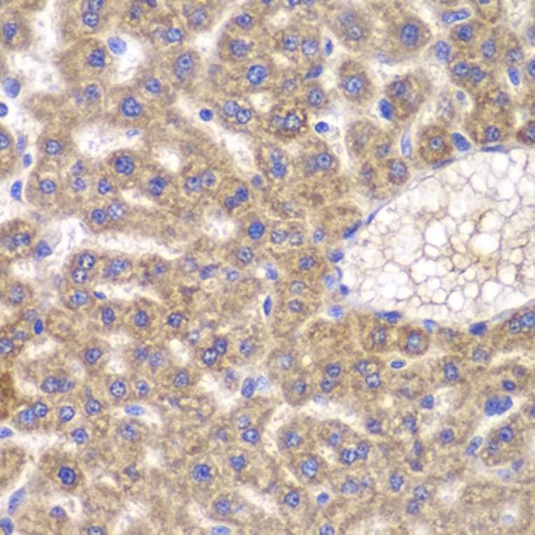 Immunohistochemistry - Anti-FASTK Antibody (A7069) - Antibodies.com