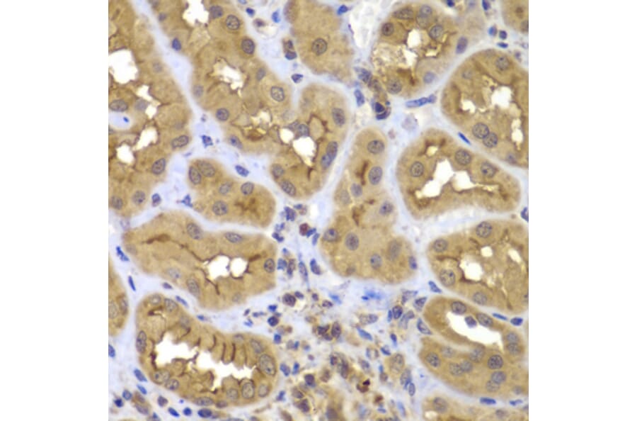 Immunohistochemistry - Anti-FASTK Antibody (A7069) - Antibodies.com