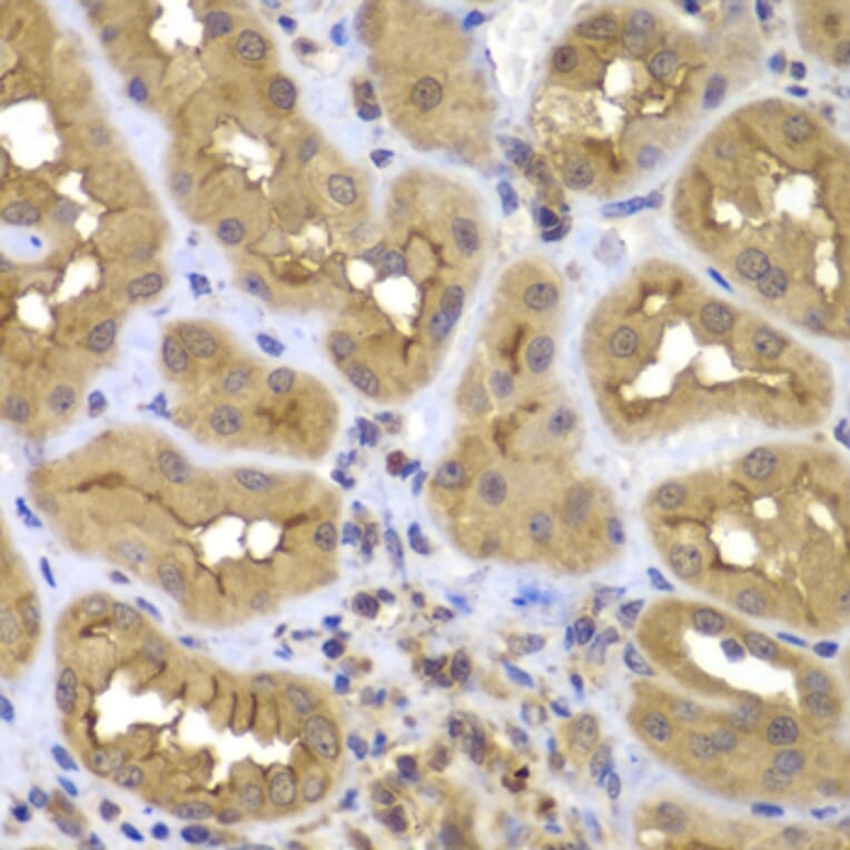 Immunohistochemistry - Anti-FASTK Antibody (A7069) - Antibodies.com